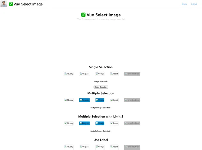 screenshot of Vue Select Image