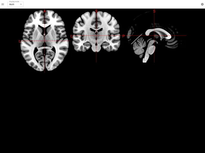 screenshot of Niivue UI